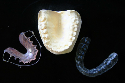 Ortodonzia e Gnatologia